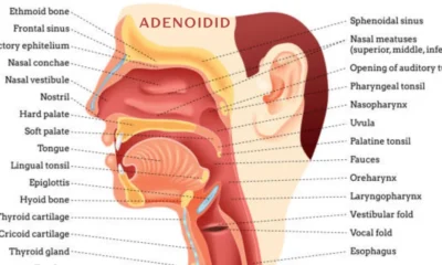 adenoidid